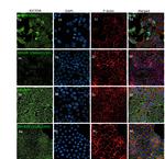 RICTOR Antibody