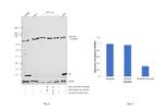 RICTOR Antibody in Western Blot (WB)