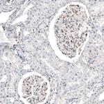 TFE3 Antibody in Immunohistochemistry (Paraffin) (IHC (P))