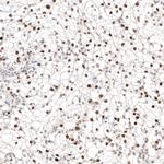 TFE3 Antibody in Immunohistochemistry (Paraffin) (IHC (P))