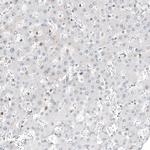 TFE3 Antibody in Immunohistochemistry (Paraffin) (IHC (P))