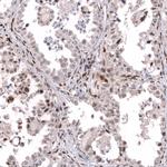 TFE3 Antibody in Immunohistochemistry (Paraffin) (IHC (P))