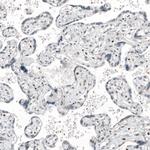 TFE3 Antibody in Immunohistochemistry (Paraffin) (IHC (P))