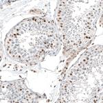 TFE3 Antibody in Immunohistochemistry (Paraffin) (IHC (P))