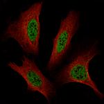 TFE3 Antibody in Immunocytochemistry (ICC/IF)