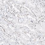 TFE3 Antibody in Immunohistochemistry (Paraffin) (IHC (P))