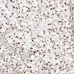 TFE3 Antibody in Immunohistochemistry (Paraffin) (IHC (P))