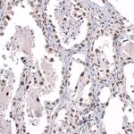 TFE3 Antibody in Immunohistochemistry (Paraffin) (IHC (P))