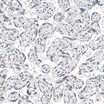 TFE3 Antibody in Immunohistochemistry (Paraffin) (IHC (P))