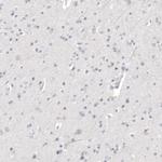 NAPSA Antibody in Immunohistochemistry (Paraffin) (IHC (P))