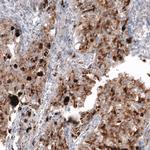 NAPSA Antibody in Immunohistochemistry (Paraffin) (IHC (P))