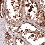 NAPSA Antibody in Immunohistochemistry (Paraffin) (IHC (P))