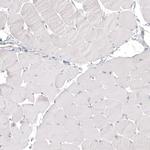 NAPSA Antibody in Immunohistochemistry (Paraffin) (IHC (P))