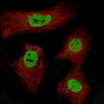 CDX2 Antibody in Immunocytochemistry (ICC/IF)