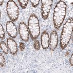 CDX2 Antibody in Immunohistochemistry (Paraffin) (IHC (P))