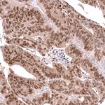 CDX2 Antibody in Immunohistochemistry (Paraffin) (IHC (P))