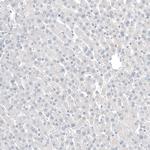 CDX2 Antibody in Immunohistochemistry (Paraffin) (IHC (P))