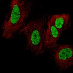 CDX2 Antibody in Immunocytochemistry (ICC/IF)