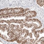 CDX2 Antibody in Immunohistochemistry (Paraffin) (IHC (P))