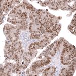 CDX2 Antibody in Immunohistochemistry (Paraffin) (IHC (P))