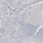 CDX2 Antibody in Immunohistochemistry (Paraffin) (IHC (P))