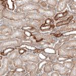 Glypican 3 Antibody in Immunohistochemistry (Paraffin) (IHC (P))