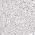 Glypican 3 Antibody in Immunohistochemistry (Paraffin) (IHC (P))