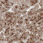 Glypican 3 Antibody in Immunohistochemistry (Paraffin) (IHC (P))