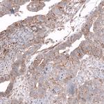 Glypican 3 Antibody in Immunohistochemistry (Paraffin) (IHC (P))