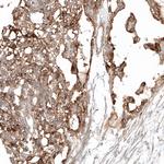 Glypican 3 Antibody in Immunohistochemistry (Paraffin) (IHC (P))