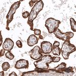 Glypican 3 Antibody in Immunohistochemistry (Paraffin) (IHC (P))