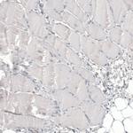 Glypican 3 Antibody in Immunohistochemistry (Paraffin) (IHC (P))