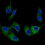 Melan-A Antibody in Immunocytochemistry (ICC/IF)