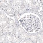 Melan-A Antibody in Immunohistochemistry (Paraffin) (IHC (P))