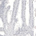 Melan-A Antibody in Immunohistochemistry (Paraffin) (IHC (P))