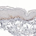 Melan-A Antibody in Immunohistochemistry (Paraffin) (IHC (P))