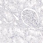 Melan-A Antibody in Immunohistochemistry (Paraffin) (IHC (P))