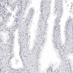 Melan-A Antibody in Immunohistochemistry (Paraffin) (IHC (P))