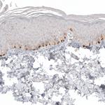 Melan-A Antibody in Immunohistochemistry (Paraffin) (IHC (P))