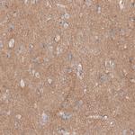 CD171 (L1CAM) Antibody in Immunohistochemistry (Paraffin) (IHC (P))