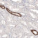 CD171 (L1CAM) Antibody in Immunohistochemistry (Paraffin) (IHC (P))