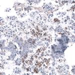 CD171 (L1CAM) Antibody in Immunohistochemistry (Paraffin) (IHC (P))