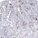 CD171 (L1CAM) Antibody in Immunohistochemistry (Paraffin) (IHC (P))