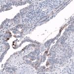 CD171 (L1CAM) Antibody in Immunohistochemistry (Paraffin) (IHC (P))