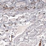 CD171 (L1CAM) Antibody in Immunohistochemistry (Paraffin) (IHC (P))