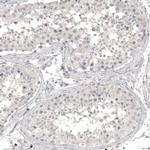 CD171 (L1CAM) Antibody in Immunohistochemistry (Paraffin) (IHC (P))