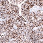 Claudin 3 Antibody in Immunohistochemistry (Paraffin) (IHC (P))