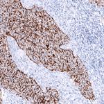 Claudin 3 Antibody in Immunohistochemistry (Paraffin) (IHC (P))