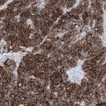 Claudin 3 Antibody in Immunohistochemistry (Paraffin) (IHC (P))