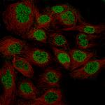 WT1 Antibody in Immunocytochemistry (ICC/IF)